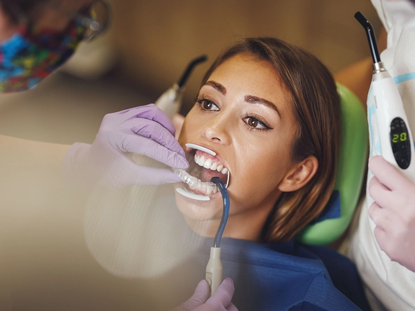 Dental Bonding in Coral Springs, FL: A Practical Guide